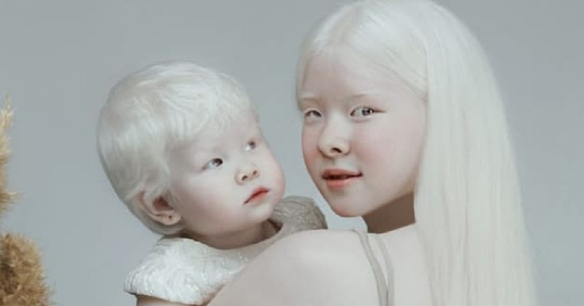 Albinozusjes gaan compleet viraal vanwege hun betoverende schoonheid.